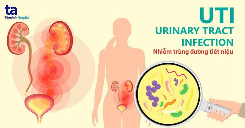 Hình ảnh minh họa hệ tiết niệu nữ và vùng bị viêm nhiễm gây mắc tiểu liên tục nhưng tiểu ít